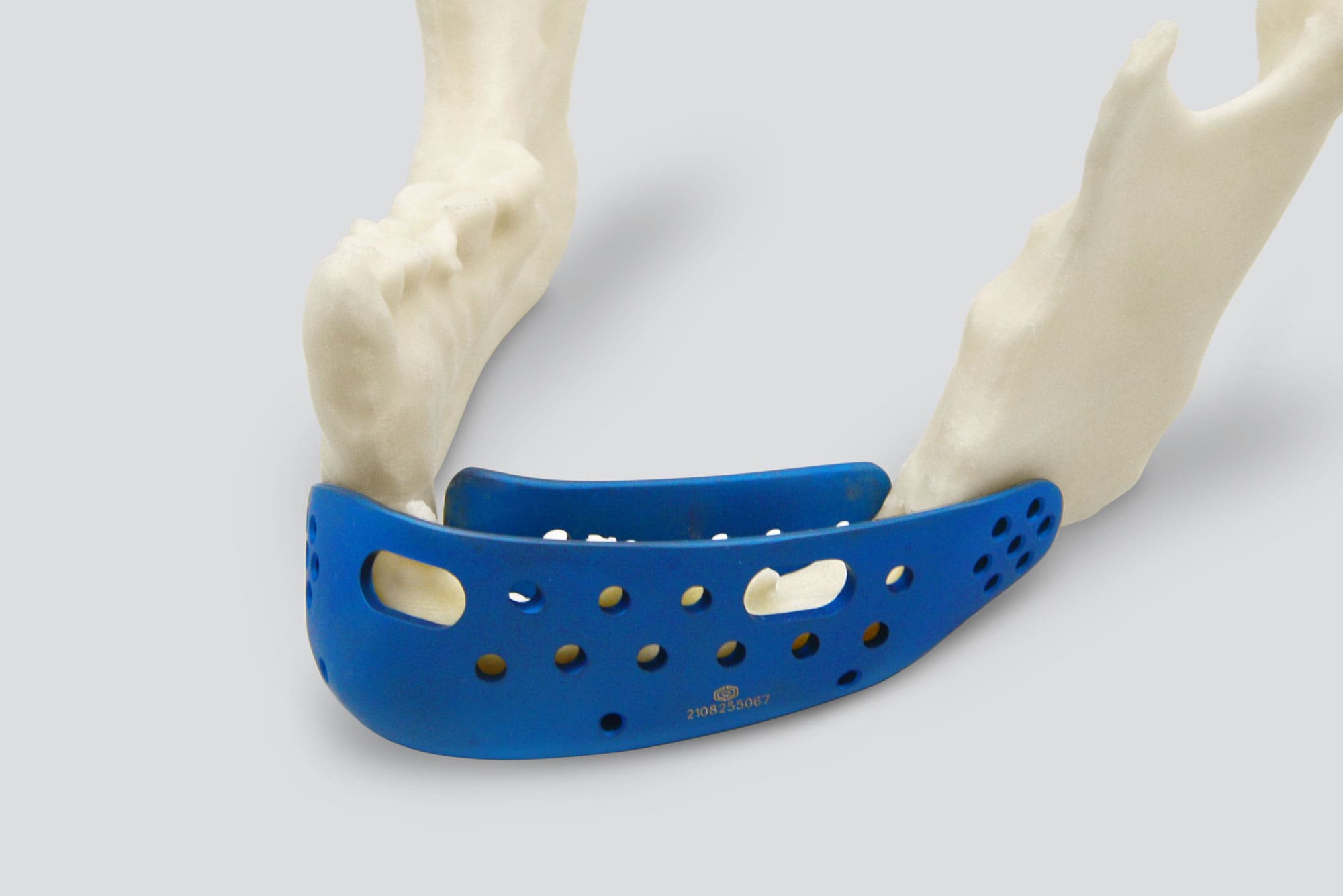 Biomodelo de mandíbula com prótese