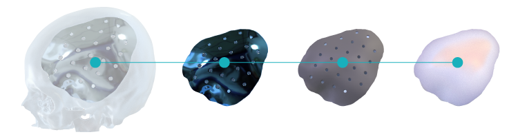 Biomateriais para cranioplastia